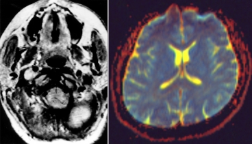 A functional magnetic resonance imaging (MRI) scan, left, and a diffuse MRI, right. Images: Functional MRI — National Institutes of Health; Diffuse MRI — Nevit Dilmen/Wikimedia Commons