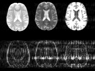 Adalsteinsson and Goyal developed an algorithm that cuts MRI exposure time by 75%