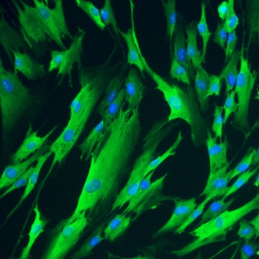 MIT researchers used RNA to induce these fibroblast cells to express four genes necessary to reprogram cells to an immature state.  Image: Yanik Laboratory